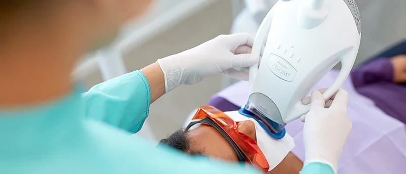 Patient receiving professional in-office teeth whitening treatment using an advanced LED whitening system