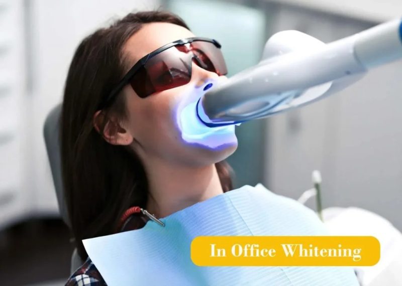 Patient receiving professional in-office teeth whitening treatment
